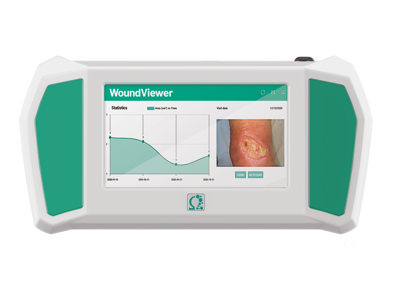 Wound Viewer Logo