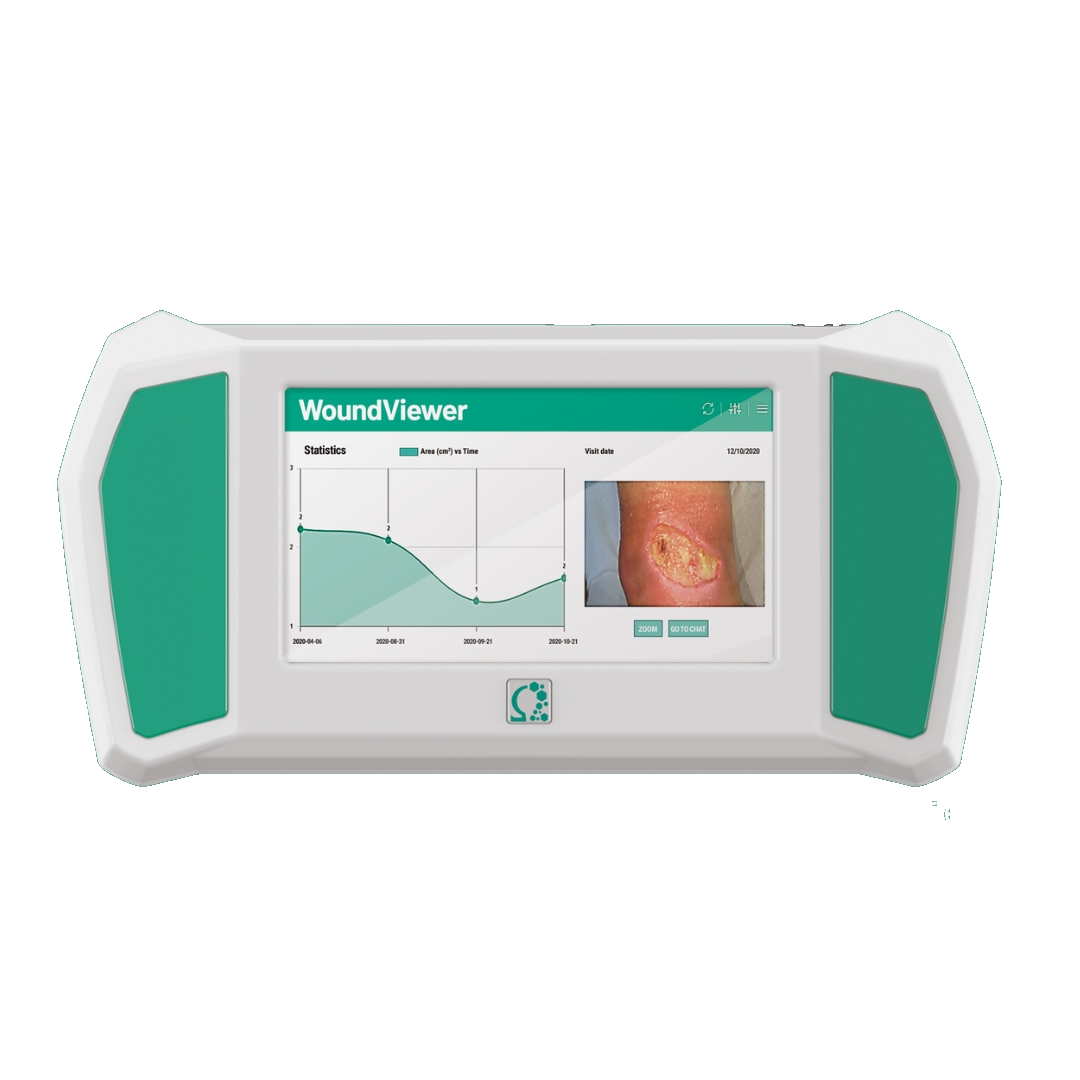 Wound Viewer